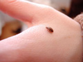 bed-bug-on-hand.jpg bed-bug-on-hand.jpg