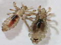 lice-englarged3.jpg Head lice.