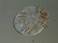 scabies-micoscopic.jpg scabies-micoscopic.jpg